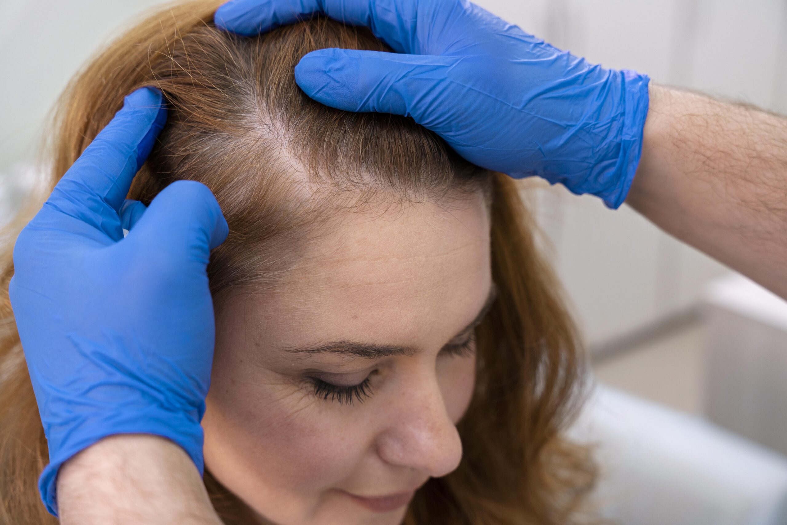 mujer-recibiendo-tratamiento-perdida-cabello-clinica